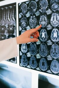 Lire la suite à propos de l’article Méthylphénidate Effet sur le cerveau : Quelles conséquences ?